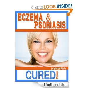 Eczema & Psoriasis CURED (Eczyma & Psoriasis) Michael Winfer 