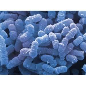  Clostridium Perfringens Bacteria are Anaerobic Food Borne 