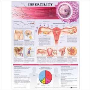 Understanding Infertility Chart  Industrial & Scientific