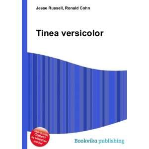  Tinea versicolor Ronald Cohn Jesse Russell Books