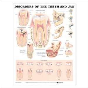 Disorders of the Teeth and Jaw Anatomical Chart 20 X 26  
