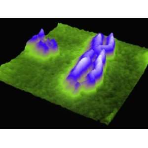 Fragile X Chromosome Made Visible by Atomic Force Microscopy (Afm 