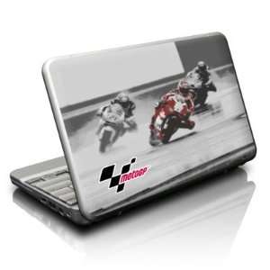  Netbook Skin (High Gloss Finish)   Accelerate Electronics