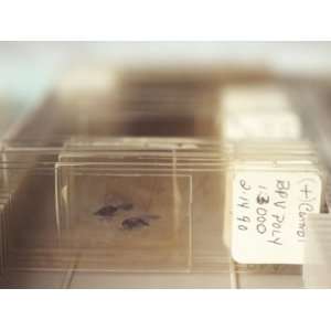 Close Up Microscope Slides with Sample,Cervical Cells Photographic 